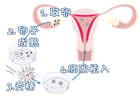 冷冻